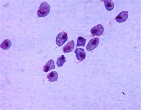 bugs on pussy|Parasitic STDs and how to get rid of them .